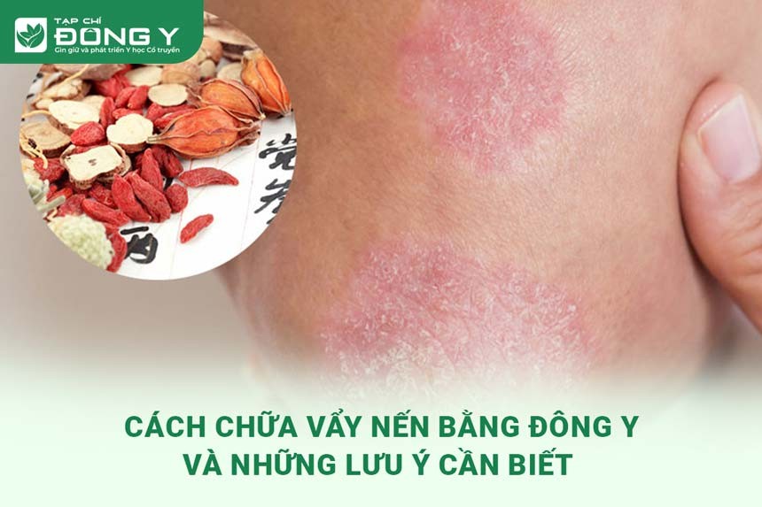 Hinh Anh Chua Vay Nen Bang Dong Y 1